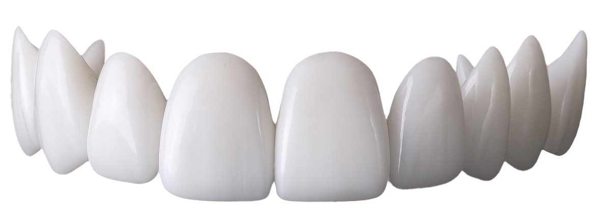 Shiny Smile Veneers Review (2026): Are These Snap-On Veneers Legit?